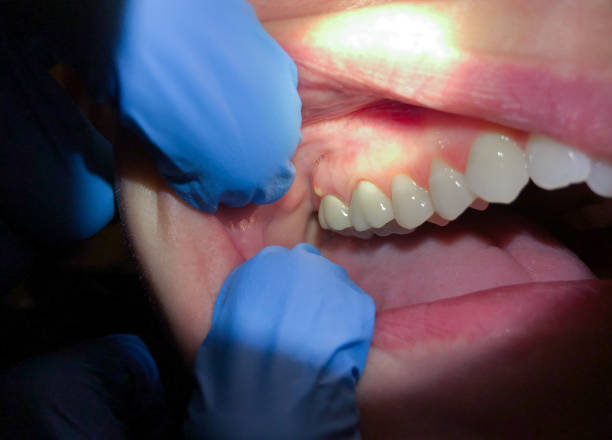 Best Emergency Dental Services for Seniors in Coloma, MI