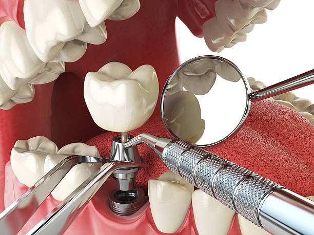 Best Mobile Emergency Dentist in Coloma, MI